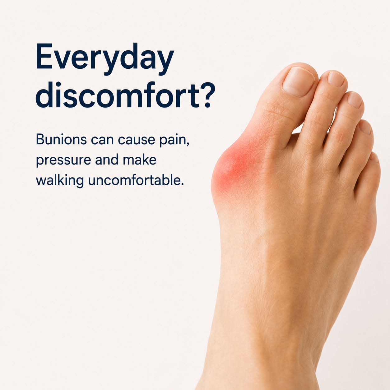 Bunion Corrector